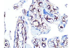 Immunohistochemistry of paraffin-embedded human placenta using Caldesmon Rabbit mAb (ABIN7266024) at dilution of 1:100 (40x lens). (Caldesmon Antikörper)