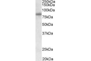 SDCCAG8 Antikörper  (Internal Region)