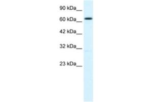 Western Blotting (WB) image for anti-Potassium Intermediate/small Conductance Calcium-Activated Channel, Subfamily N, Member 2 (KCNN2) antibody (ABIN2461098) (KCNN2 Antikörper)