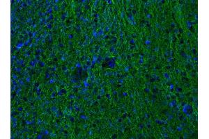 Indirect immunostaining of PFA-fixed mouse brain section (dilution 1 : 500; green). (alpha Tubulin Antikörper  (AA 419-435))