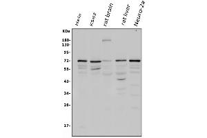 Western blot analysis of POT1 using anti-POT1 antibody (ABIN3043444). (POT1 Antikörper  (N-Term))