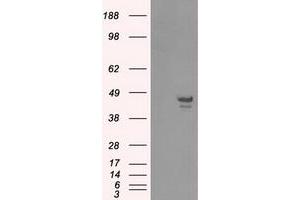Western Blotting (WB) image for anti-Calcium/calmodulin-Dependent Protein Kinase ID (CAMK1D) antibody (ABIN1497086)