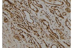 ABIN6277733 at 1/100 staining Human kidney tissue by IHC-P. (RAD21 Antikörper  (C-Term))