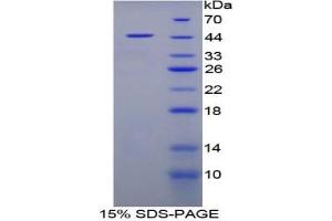SDS-PAGE analysis of Pig FABP4 Protein.