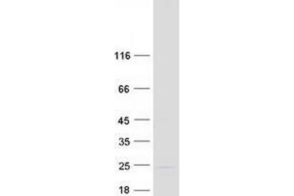 TMEM35 Protein (Myc-DYKDDDDK Tag)