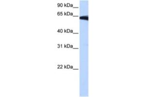 Western Blotting (WB) image for anti-Phosphatidylinositol Glycan W (PIGW) antibody (ABIN2463266) (PIGW Antikörper)