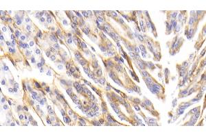 Immunohistochemistry (IHC) image for anti-Procollagen III N-Terminal Propeptide (PIIINP) (AA 24-154) antibody (ABIN7445201)