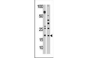 Western blot analysis of RPL23A polyclonal antibody  in HepG2 (left) and mouse liver (right) cell line lysates (35 ug/lane).