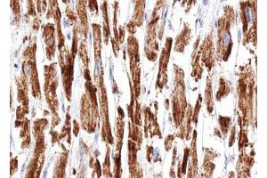 ABIN6266951 at 1/100 staining human Heart muscle tissue sections by IHC-P. (DOK7 Antikörper  (C-Term))