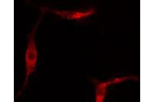 ABIN6267332 staining Hela cells by IF/ICC. (Ret Proto-Oncogene Antikörper  (pTyr1062))