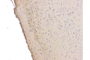 IHC analysis of SRCIN1 using anti-SRCIN1 antibody (ABIN6719623). (SRCIN1 Antikörper  (AA 189-287))