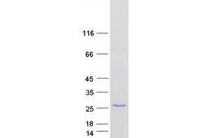 Validation with Western Blot (BET3L/TRAPPC3L Protein (Myc-DYKDDDDK Tag))