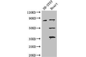 Western Blot Positive WB detected in: SH-SY5Y whole cell lysate, Mouse heart tissue All lanes: MAPT antibody at 3. (MAPT Antikörper  (AA 33-166))