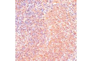 Immunohistochemistry of paraffin-embedded rat spleen using IL4R antibody (ABIN7268001) at dilution of 1:100 (40x lens). (IL4 Receptor Antikörper  (AA 26-232))