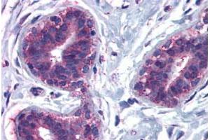 Immunohistochemical staining of human breast, lobular epithelium with CELSR2 polyclonal antibody . (CELSR2 Antikörper  (N-Term))