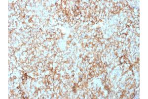Formalin-fixed, paraffin-embedded human Tonsil stained with CD73 Mouse Monoclonal Antibody (NT5E/2503). (CD73 Antikörper)