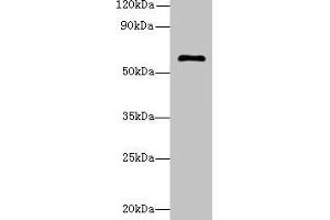 Western blot All lanes: GK5 antibody at 4 μg/mL + K562 whole cell lysate Secondary Goat polyclonal to rabbit IgG at 1/10000 dilution Predicted band size: 60, 34, 28 kDa Observed band size: 60 kDa (GK5 Antikörper  (AA 96-301))