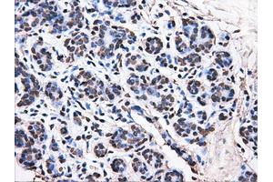 Immunohistochemical staining of paraffin-embedded breast tissue using anti-ATP5B mouse monoclonal antibody. (ATP5B Antikörper)