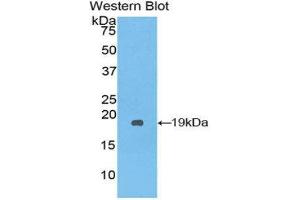 Western Blotting (WB) image for anti-serpin Peptidase Inhibitor, Clade A (Alpha-1 Antiproteinase, Antitrypsin), Member 10 (SERPINA10) (AA 6-125) antibody (ABIN1175353)