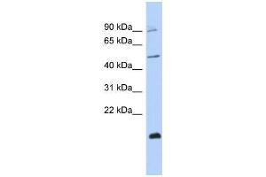 Human MCF-7; WB Suggested Anti-ZNF645 Antibody Titration: 0. (ZNF645 Antikörper  (Middle Region))