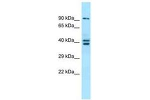 Image no. 1 for anti-L(3)mbt-Like 3 (L3MBTL3) (N-Term) antibody (ABIN6744892) (L3MBTL3 Antikörper  (N-Term))