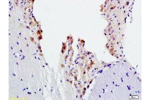 Formalin-fixed and paraffin embedded rat brain tissue labeled with Anti-ADRB2 Polyclonal Antibody, Unconjugated  at 1:200, followed by conjugation to the secondary antibody and DAB staining (beta 2 Adrenergic Receptor Antikörper  (AA 201-300))