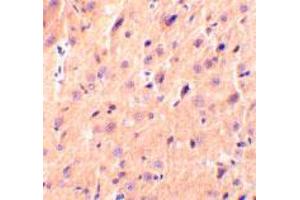 Immunohistochemical staining of rat brain tissue using CBLN1 polyclonal antibody  at 2 ug/mL . (CBLN1 Antikörper  (Internal Region))