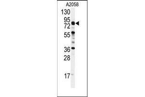 Western blot analysis of anti-COG4 Antibody (C-term) in A2058 cell line lysates (35ug/lane).