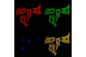 ABIN6259962 and ABIN6273032 staining Hela cells by IF/ICC.