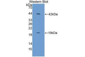 Western blot analysis of recombinant Mouse IL1R1. (IL1R1 Antikörper  (AA 20-338))
