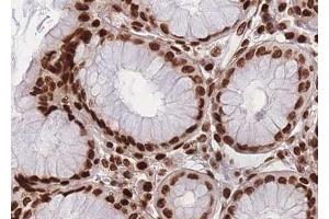 ABIN6267016 at 1/100 staining human Stomach tissue sections by IHC-P.
