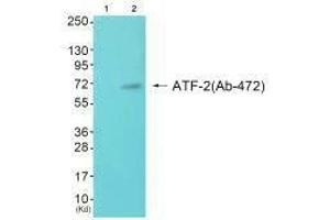Western blot analysis of extracts from JK cells (Lane 2), using ATF-2 (Ab-472) antiobdy. (ATF2 Antikörper  (Ser472))