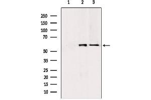 Western blot analysis of extracts from various samples, using PKLR antibody. (PKLR Antikörper  (Internal Region))