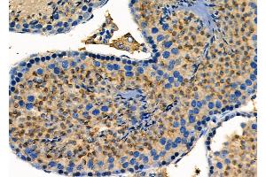 ABIN6259277 and ABIN6275432 at 1/100 staining Mouse testis tissue by IHC-P.