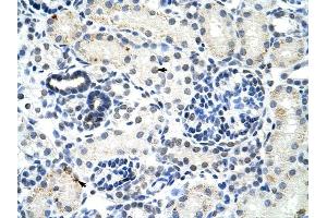 DDX17 antibody was used for immunohistochemistry at a concentration of 4-8 ug/ml to stain Epithelial cells of renal tubule (arrows) in Human Kidney. (DDX17 Antikörper)