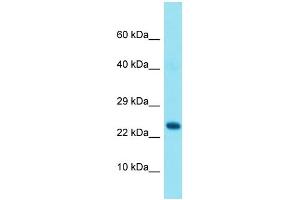 Western Blotting (WB) image for anti-GRB2-Related Adaptor Protein (GRAP) (N-Term) antibody (ABIN2791566) (GRAP Antikörper  (N-Term))