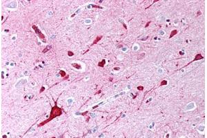 anti-TGF-beta (TGFb) antibody