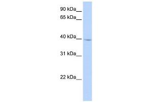IQCD antibody used at 1 ug/ml to detect target protein. (IQCD Antikörper  (N-Term))