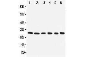 Anti-Apoptosis repressor with CARD antibody, Western blotting Lane 1: SMMC Cell Lysate Lane 2: A549 Cell Lysate Lane 3: U87 Cell Lysate Lane 4: HELA Cell Lysate Lane 5: MCF-7 Cell Lysate Lane 6: Rat Liver Tissue Lysate (NOL3 Antikörper  (Middle Region))