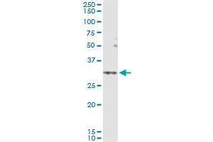 Immunoprecipitation of SLC25A5 transfected lysate using rabbit polyclonal anti-SLC25A5 and Protein A Magnetic Bead