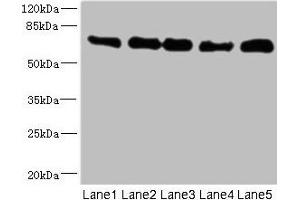 Western blot All lanes: NUMB antibody at 0. (NUMB Antikörper  (AA 532-651))