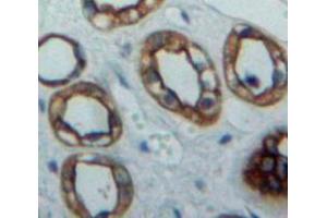 Used in DAB staining on fromalin fixed paraffin-embedded Kidney tissue (PVRL2 Antikörper  (AA 76-353))