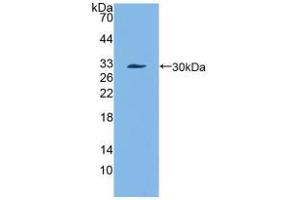 Western blot analysis of recombinant Mouse a1ACT.
