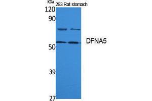 Western Blotting (WB) image for anti-Deafness, Autosomal Dominant 5 (DFNA5) (Internal Region) antibody (ABIN3187614) (DFNA5 Antikörper  (Internal Region))