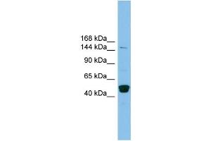 WB Suggested Anti-PRDM10 Antibody Titration: 0. (PRDM10 Antikörper  (Middle Region))