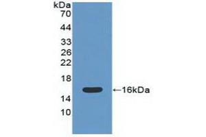 Detection of Recombinant CAT, Mouse using Polyclonal Antibody to Catalase (CAT) (Catalase Antikörper  (AA 32-157))