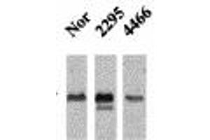 Image no. 1 for anti-Calcium/calmodulin-Dependent Protein Kinase II beta (CAMK2B) (pThr286), (Thr287) antibody (ABIN466897) (CAMK2B Antikörper  (pThr286, Thr287))