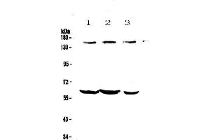 Western blot analysis of KCNH1 using anti-KCNH1 antibody . (KCNH1 Antikörper)