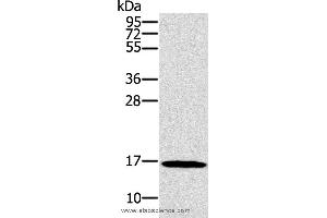 Western blot analysis of HT-29 cell, using SNCG Polyclonal Antibody at dilution of 1:800 (SNCG Antikörper)