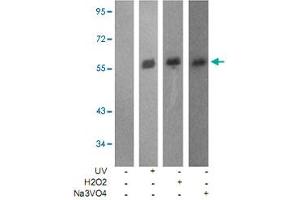 Western blot analysis of extracts from JK cells using LCK (phospho Y505) polyclonal antibody . (LCK Antikörper  (pTyr505))